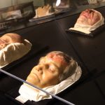 Die Geschichte der Medizin in den letzten 150 Jahren (Foto: Medizinhistorisches Museum)